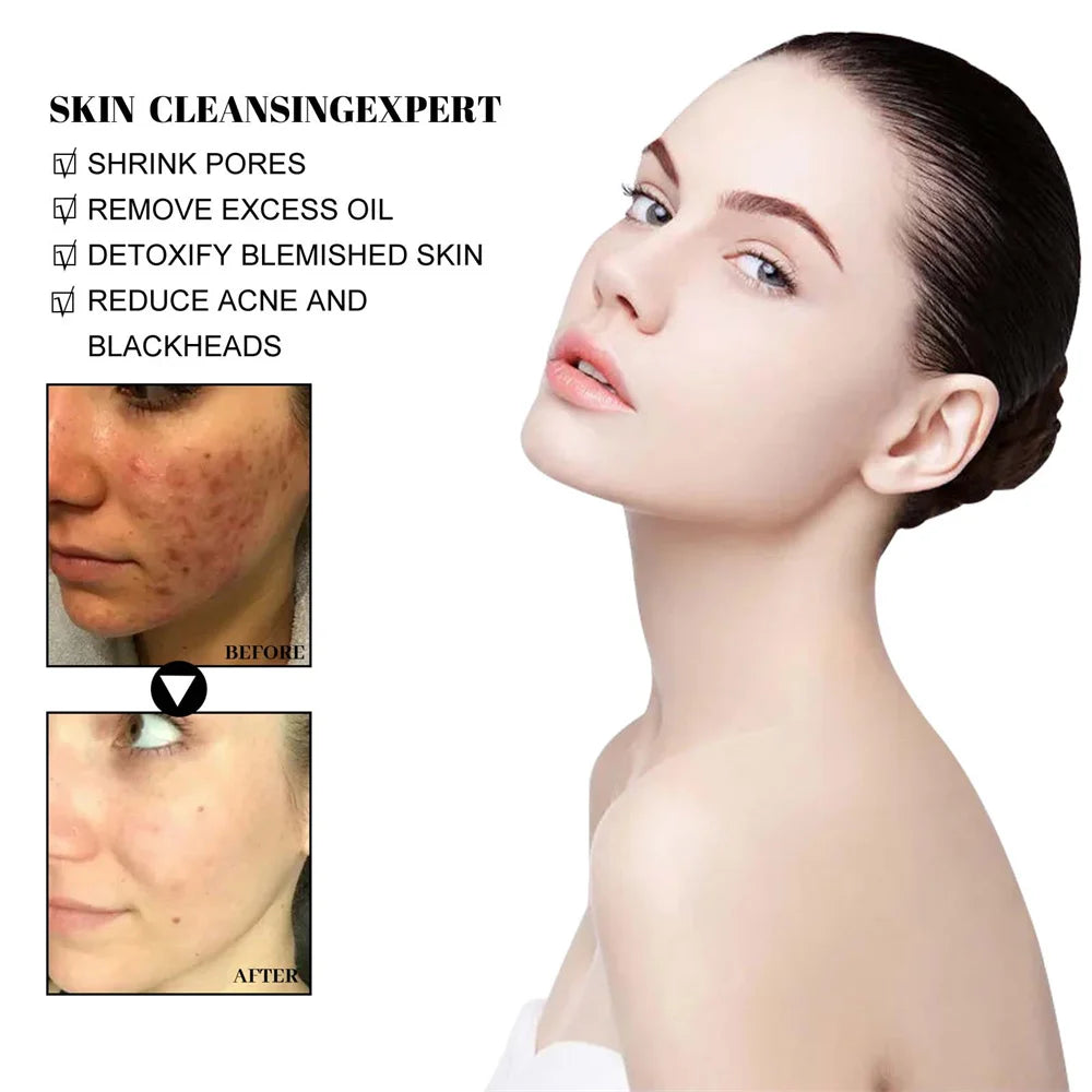 Blackhead Removal Mud Mask for Deep Pore Cleansing Care