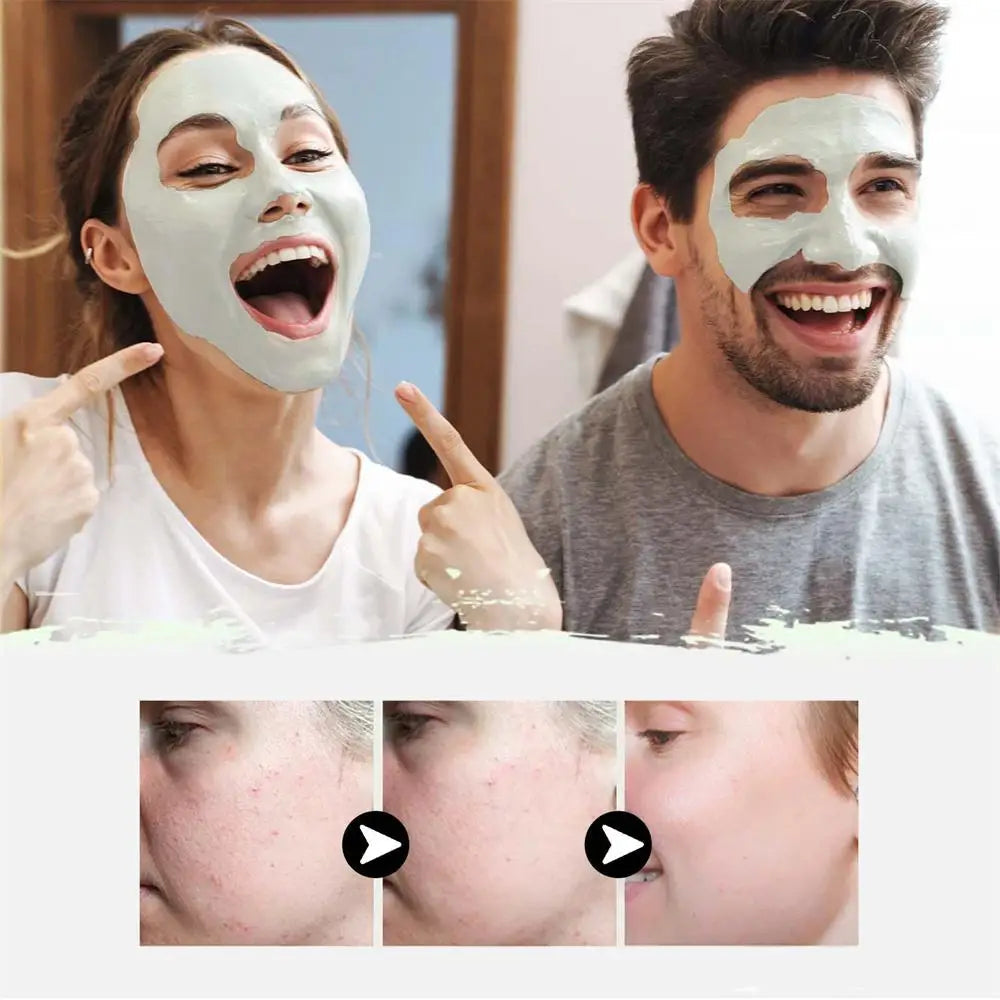 Blackhead Removal Mud Mask for Deep Pore Cleansing Care