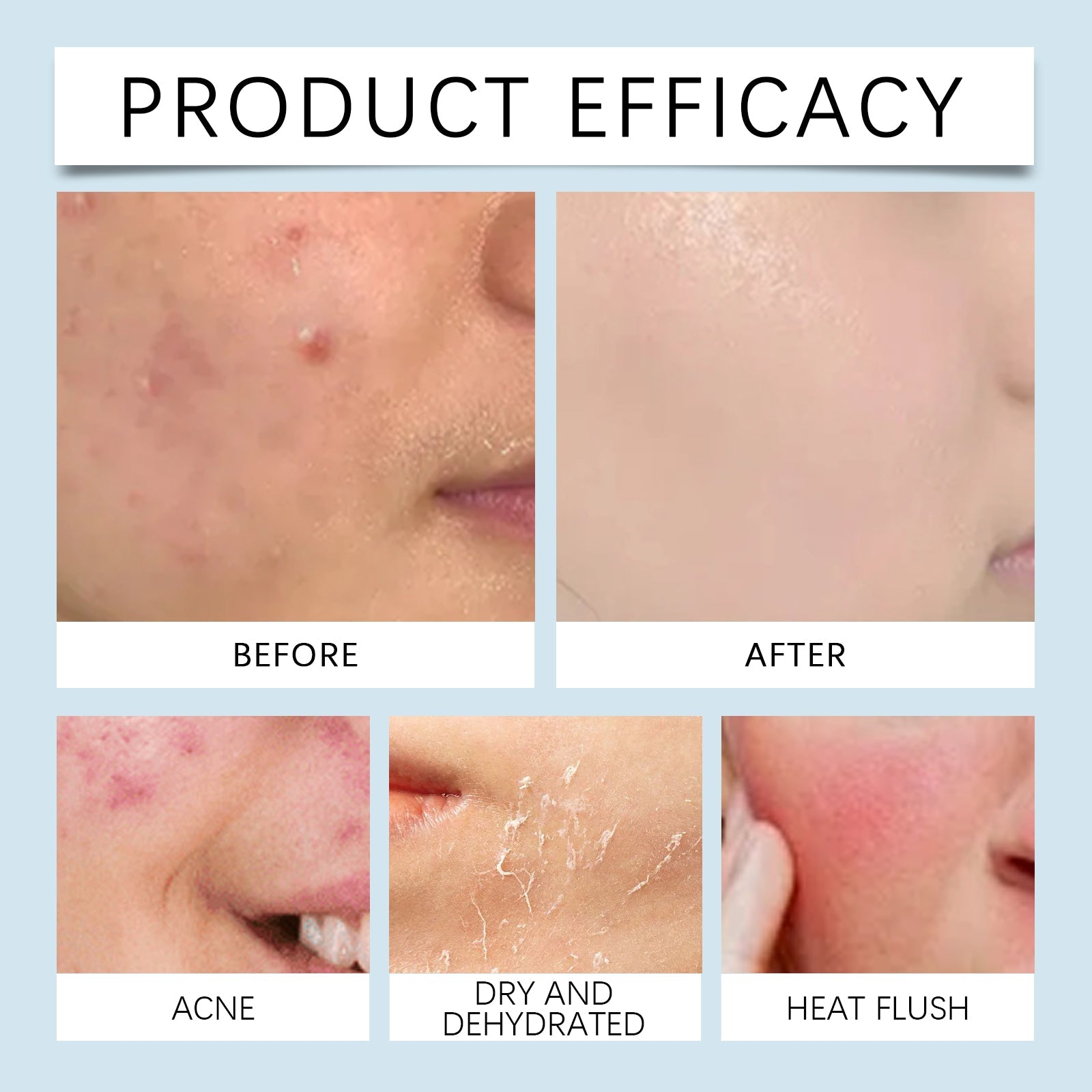Hyaluronic Acid Face Serum for Hydrating Radiant Skin Care